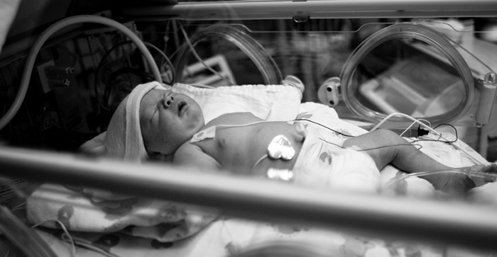 Braço de bebê recém-nascido AMPUTADO após mãe tomar vacina contra covid e bebê sofrer coágulos sanguíneos no útero
