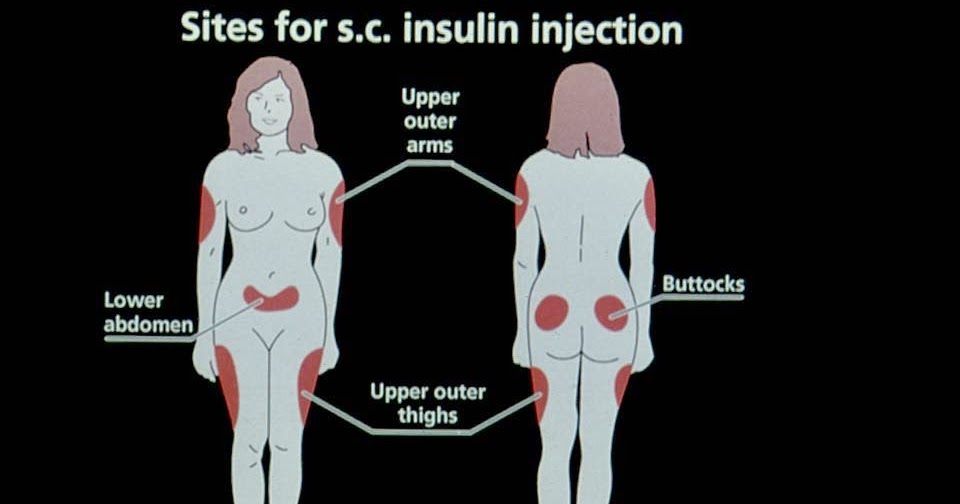 Insulin use - Practical points ~ Doctor121.com