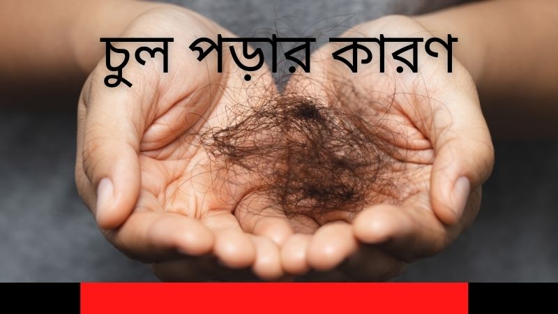 বাড়ীতে বসে চুল পরা কমানোর উপায়ঃ