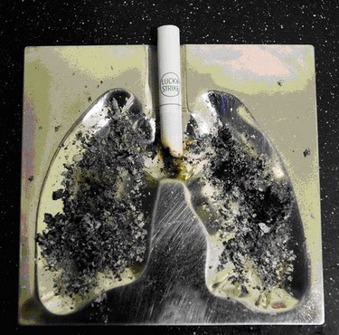 Penyebab  dan Gejala Kanker  Paru paru 