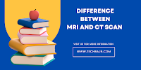 Difference Between MRI and CT scan