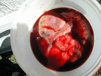 placenta