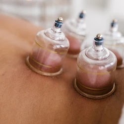 A Close-Up of a cupping massage