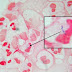 Mycobacterium Tuberculosis Morphology