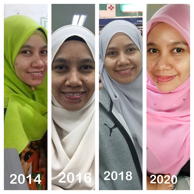 set cantik premium shaklee, set cantik kurus shaklee, set cantik shaklee 2021,set cantik shaklee, set cantik bajet shaklee, set cantik basic shaklee, set cantik flawless shaklee,