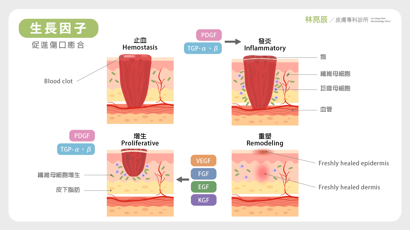 PLT凍晶醫美新竹推薦生長因子功效效果