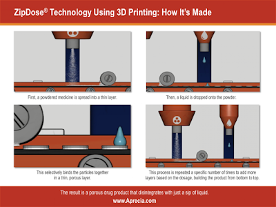 Los “Milagros” se realizan con 3D Rapid Manufacturing - ZIPDOSE