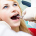 Nguyên nhân nhổ răng bị nhiễm trùng