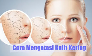 Cara Mengatasi Kulit Kering dan Kusam Pada Wajah Secara Alami