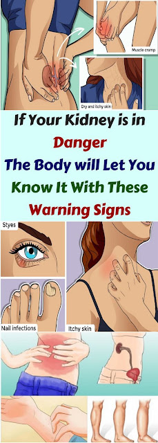 If Your Kidney In Danger The Body Will Let You Know It & This Warning Signs!!!