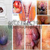 Obat Ambeien atau Hemorrhoid Buat Ibu Hamil thumbnail