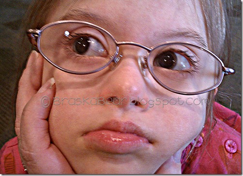 dilatedeyes