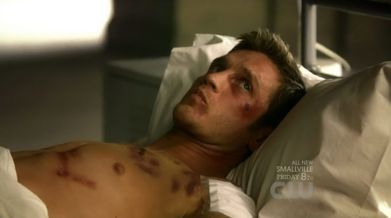 Devon Sawa Shirtless on Nikita s1e07