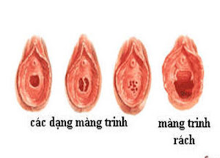 Màng trinh của con gái sâu bao nhiêu cm?