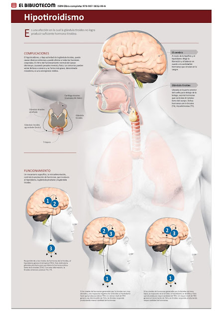  imagen-hipotiroidismo