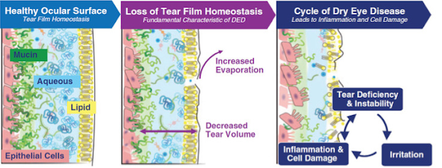 Oyster Point Pharmaceuticals-Nasal Spray for Dry Eye Disease