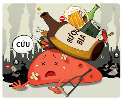 Một trong những lí do thông dụng của bênh gout là bia rượu