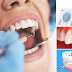 Cạo vôi răng an toàn tại nha khoa