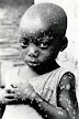 Fear As Monkey Pox Spreads To Uyo, Port Harcourt...Lagos On High Alert