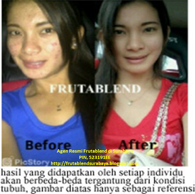 Jual Frutablend Blitar - Distributor  Agen  Stokis Resmi 