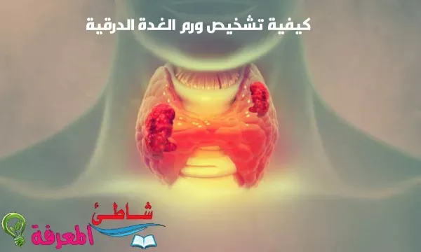 كيفية تشخيص ورم الغدة الدرقية