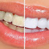 8 Tips Cepat Membuat Gigi Tampak Lebih Putih Alami