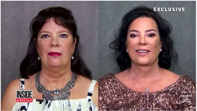 Kris Jenner's sister undergoes surgery to look like her