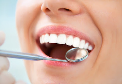 Niềng răng mắc cài sứ có hiệu quả không?