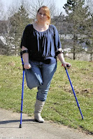 Amputee girls legs, stumps and prostheses