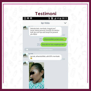 Testimoni Menghilangkan Jerawat Membandel Dan Mencerahkan Wajah pratista (67)