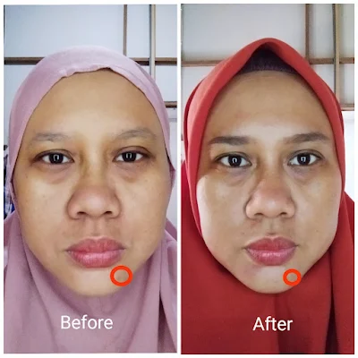 Hasil pemakaian toner dan serum Reset