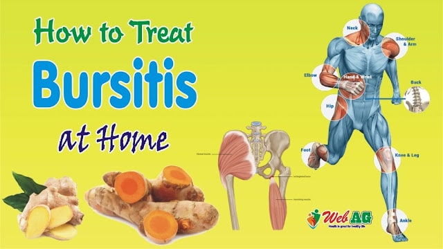 2 Natural Remedies for Bursitis