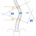 解密脊椎側彎矯正治療-功敗垂成的原因