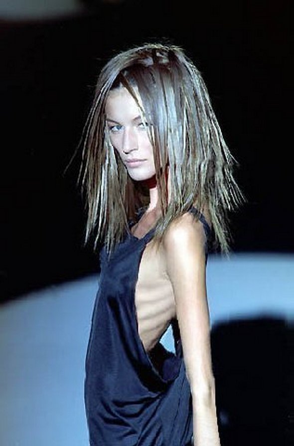 anorexic person in world. Anorexic Models don#39;t