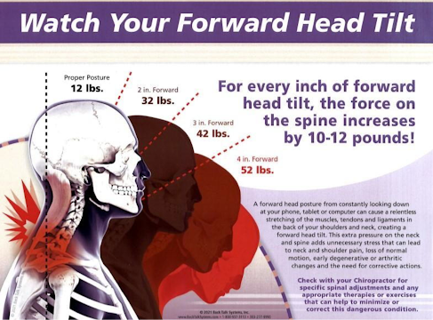 Forward Head Tilt flyer photo