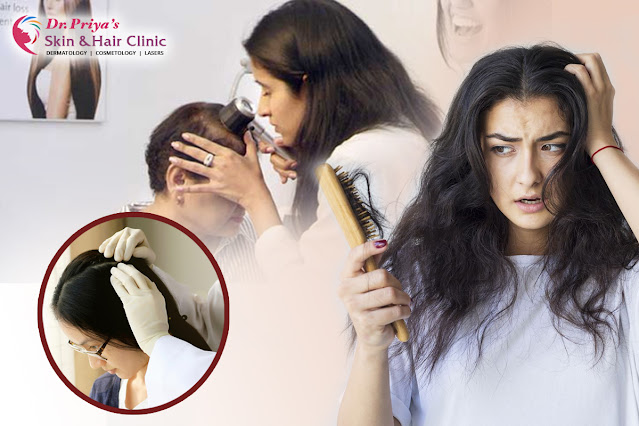 Best Hair Doctor in Bangalore