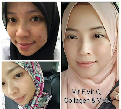 TESTIMONI VIVIX