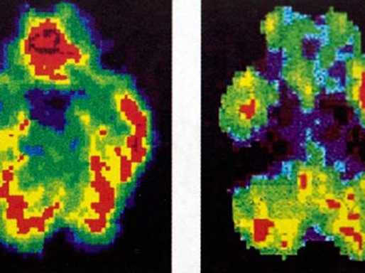 Brain Versus Capital5