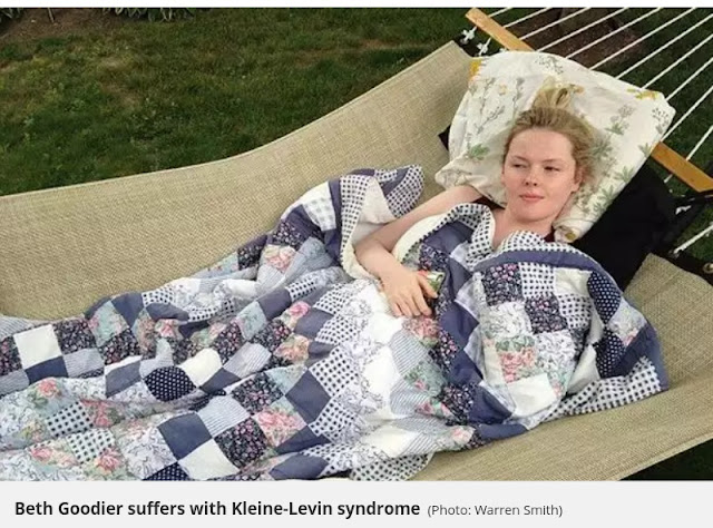  Beth Goodier, 22, diagnosed with Kleine-Levin syndrome (Photo: Warren Smith)