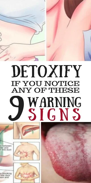 Detoxify Your Body Immediately If You Notice Any Of These 9 Warning Signs