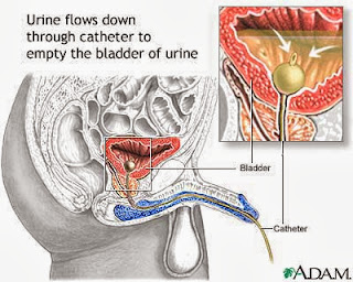 Urinary Tract Infection Center 