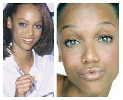 blake lively nose job before and after. Tyra Banks Before After