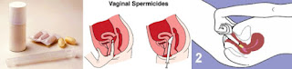 spermisida vagina