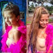 Six-year-old girl beats the odds after being born with her heart outside her chest