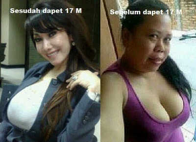 GressMed: FOTO : Malinda DEE sebelum dan sesudah menjalani 