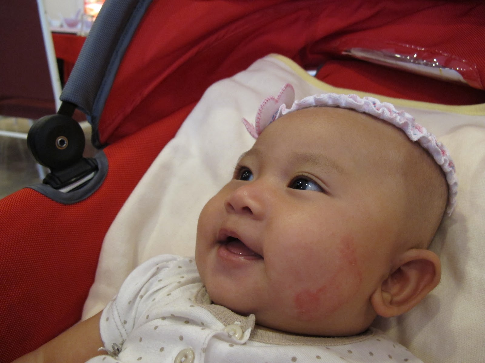 Precious life: Mengendalikan Bayi Eczema