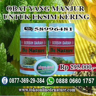 OBAT YANG MANJUR UNTUK EKSIM KERING