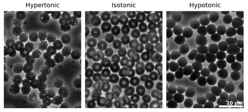 Mekanisme osmosis pada sel darah merah