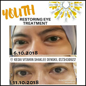 Youth Eye Treatment