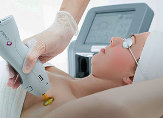 Laser Hair Removal, Los Angeles